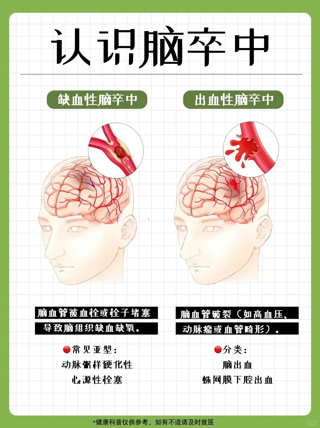 2026年脑卒中与生活方式的关系大揭秘