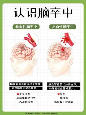 2026年脑卒中与生活方式的关系大揭秘